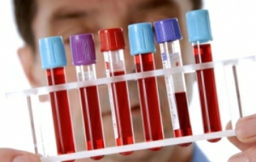 Анализ крови может предсказать вероятность смерти в следующие 5 лет